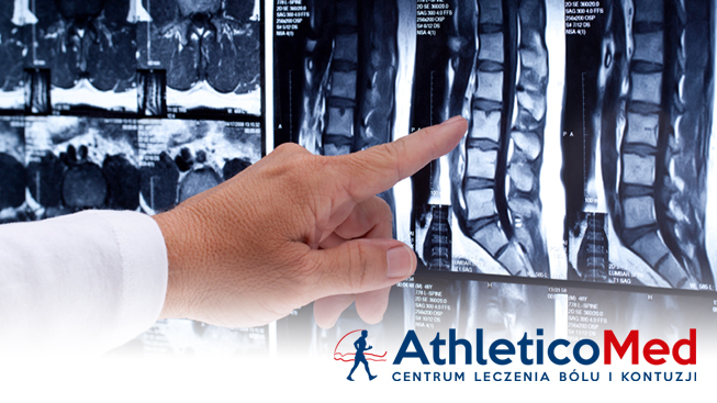 athleticomed_spine_mis